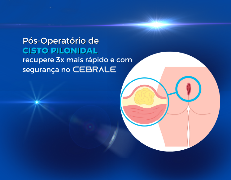 pós-operatório de cisto pilonidal
