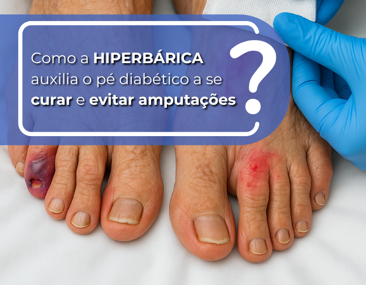 Como a Hiperbárica auxilia o Pé Diabético a se curar e evitar amputações?