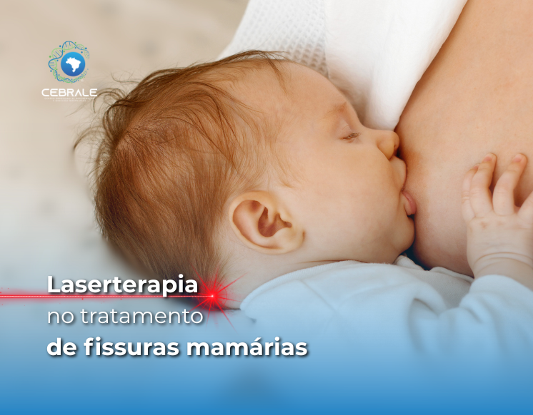 laserterapia fissuras mamárias